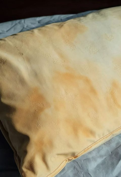 The Yellow Pillow Struggle Is Real (But Fixable!)