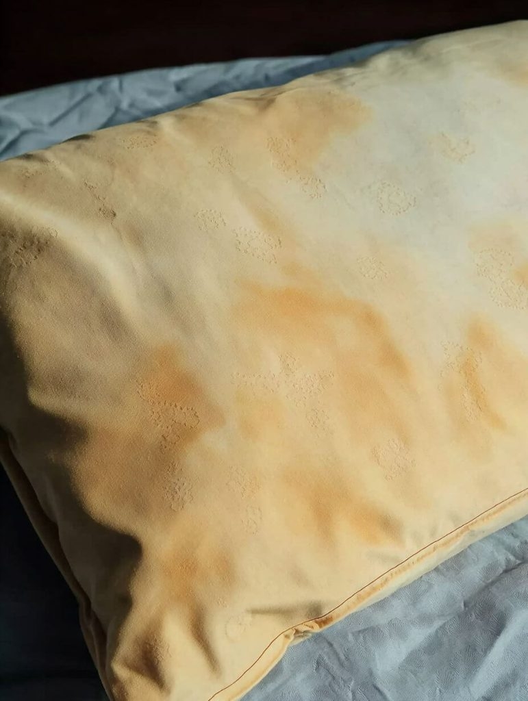 The Yellow Pillow Struggle Is Real (But Fixable!)